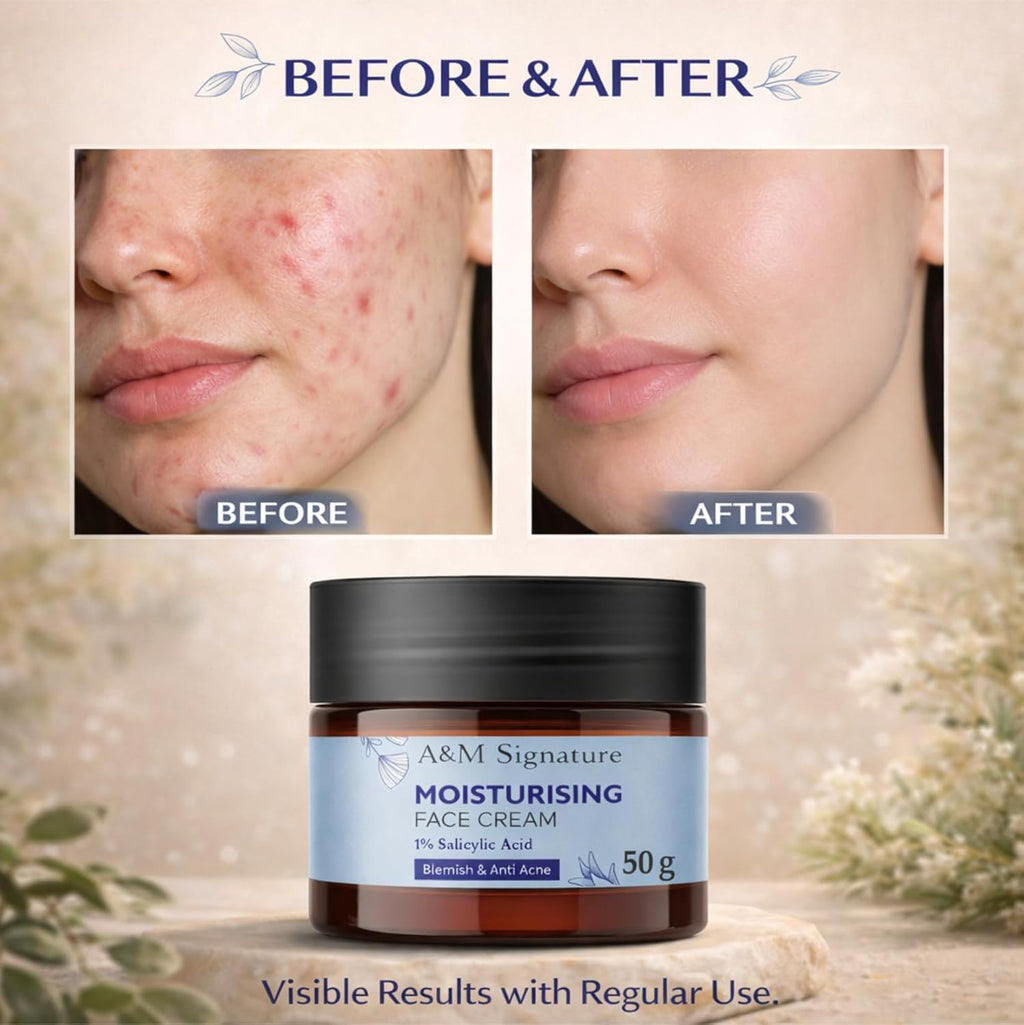 A&M Signature Moisturising Face Cream | 1% Salicylic Acid | Helps Reduce Blemishes & Excess Oil | Lightweight Hydration | For Oily & Acne-Prone Skin | 50g