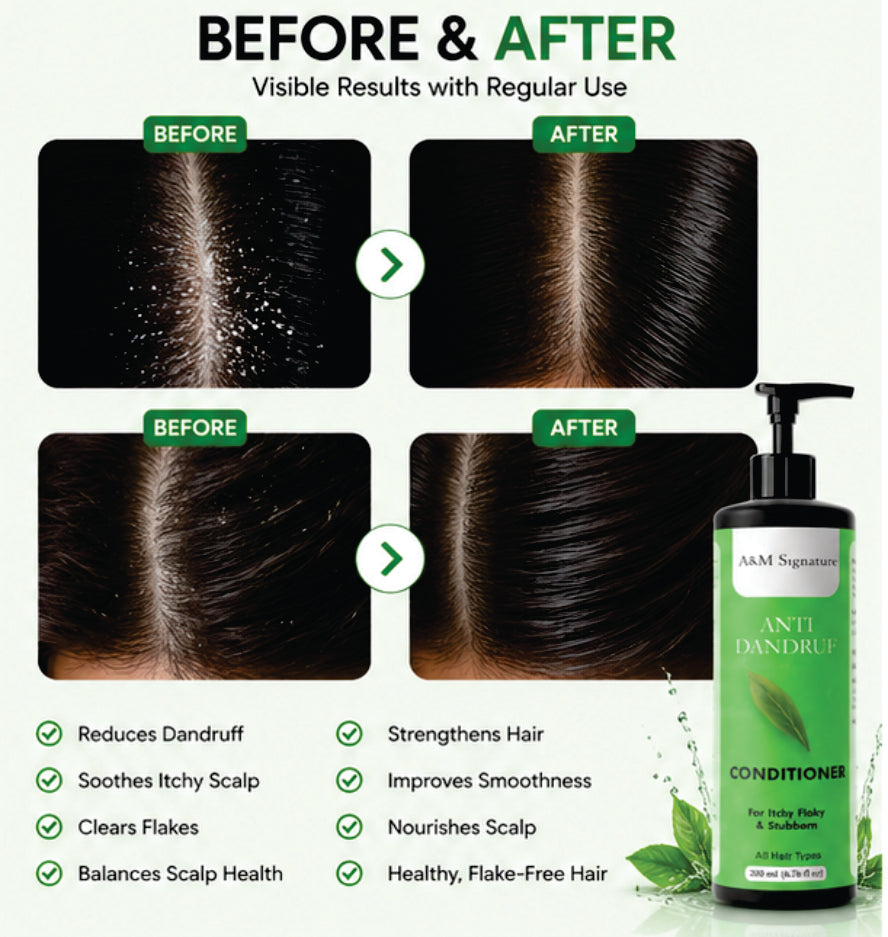 A&M Signature Anti Dandruff Conditioner for Itchy & Flaky Scalp, Deep Nourishing Conditioner for Dandruff Control & Scalp Care, Reduces Flakes & Soothes Irritation, Smoothens Hair & Controls Frizz, Suitable for All Hair Types, 200 ml