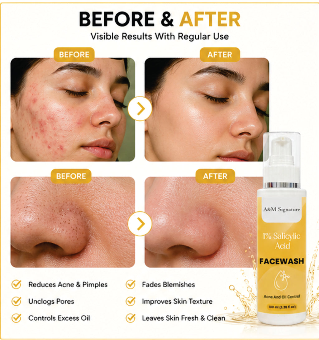 A&M Signature 1% Salicylic Acid Facewash for Acne & Oil Control, Deep Cleansing Face Wash for Pimples, Blackheads & Oily Skin, Unclogs Pores & Reduces Breakouts, Gentle Daily Cleanser, Suitable for All Skin Types, 150 ml