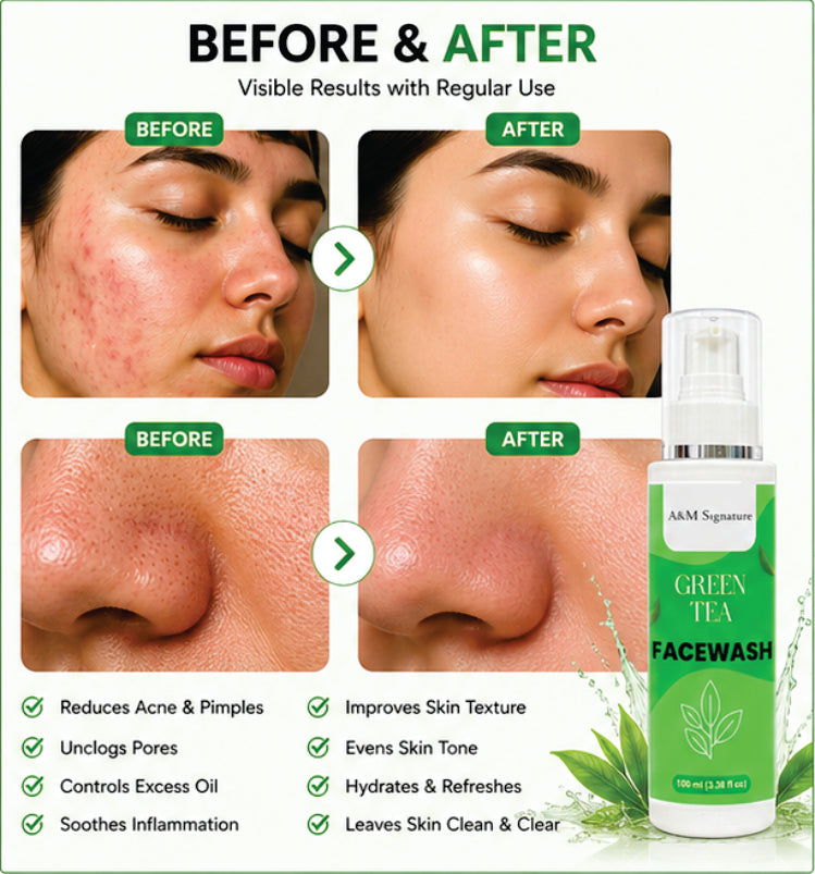 A&M Signature Green Tea Facewash for Oil Control & Fresh Skin, Gentle Daily Cleanser for Deep Cleansing, Removes Dirt & Impurities, Hydrating & Refreshing Face Wash for All Skin Types, 100 ml