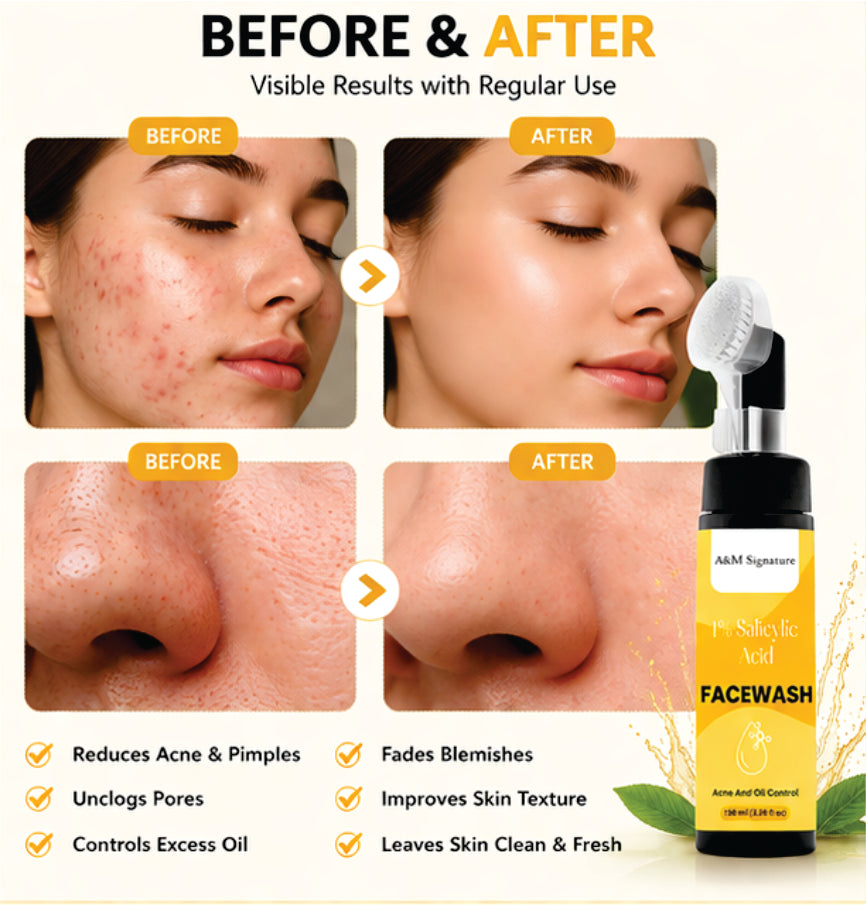 A&M Signature 1% Salicylic Acid Facewash for Acne & Oil Control, Deep Cleansing Face Wash for Pimples, Blackheads & Oily Skin, Unclogs Pores & Reduces Breakouts, Gentle Daily Cleanser, Suitable for All Skin Types, 100 ml
