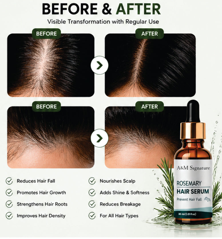 A&M Signature Rosemary Hair Serum for Hair Growth & Hair Fall Control, Lightweight Non-Greasy Serum for Stronger, Thicker & Healthier Hair, Nourishes Scalp & Reduces Breakage, Suitable for All Hair Types, 30 ml