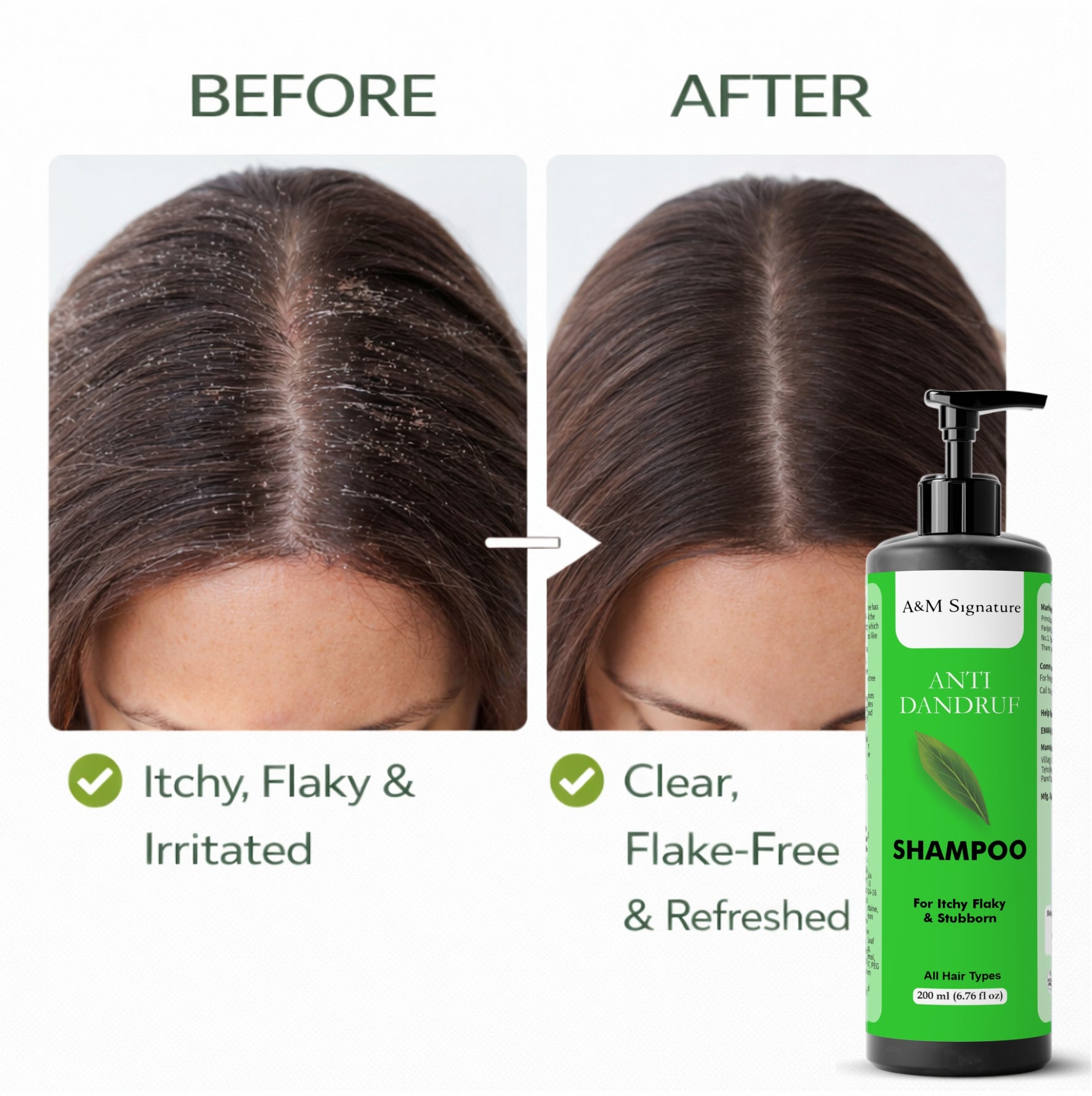 A&M Signature Anti Dandruff Shampoo | Helps Reduce Flakes & Itchy Scalp | Gentle Cleansing for Scalp Care | Suitable for All Hair Types | 200 ml