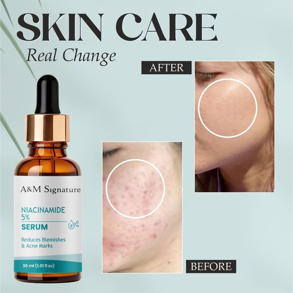 A&M Signature Niacinamide Serum for Acne Marks & Blemishes – Oil Control, Pore Minimizing & Brightening Face Serum for Clear, Smooth & Even-Toned Skin