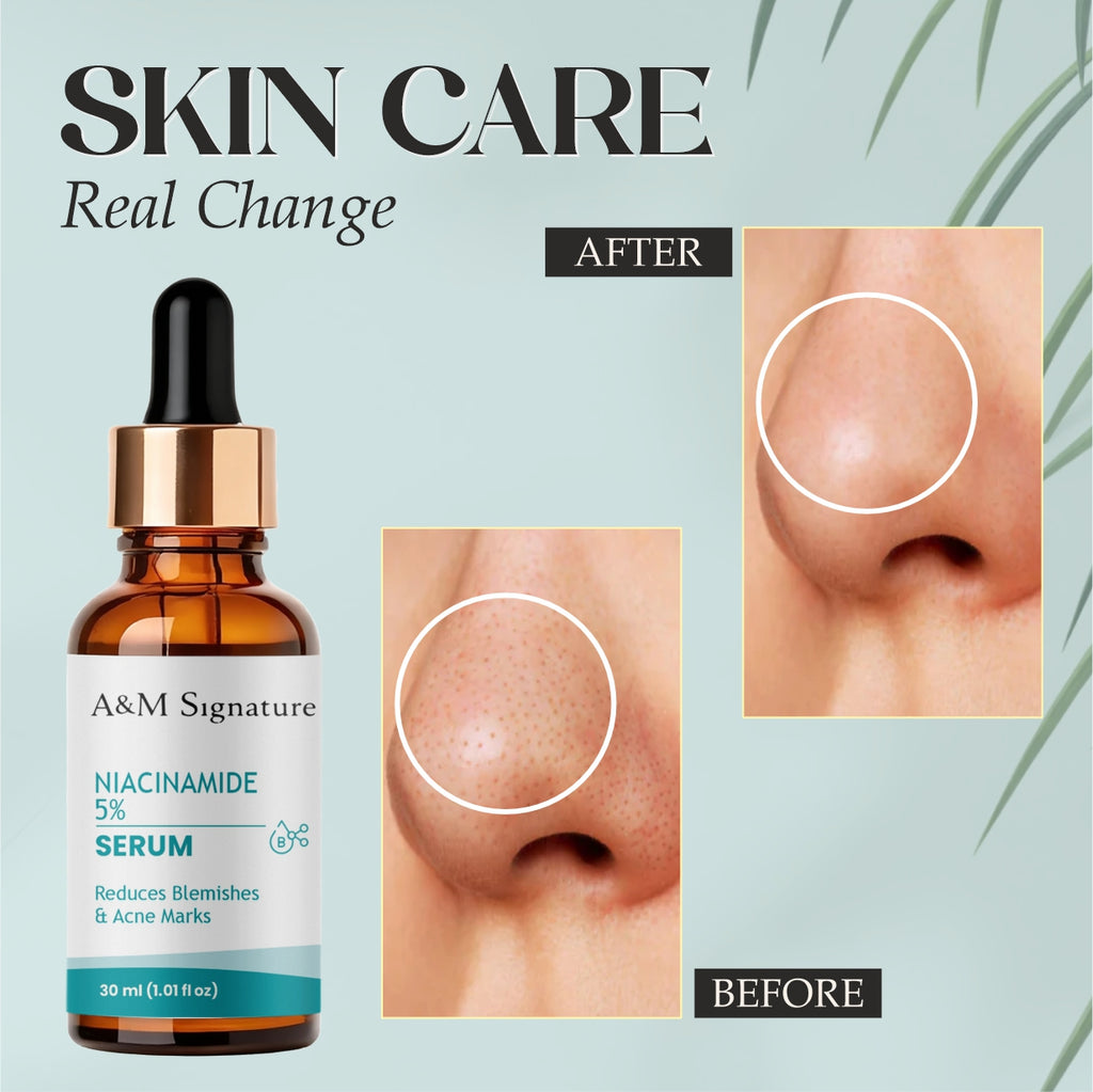 A&M Signature Niacinamide Serum for Acne Marks & Blemishes – Oil Control, Pore Minimizing & Brightening Face Serum for Clear, Smooth & Even-Toned Skin