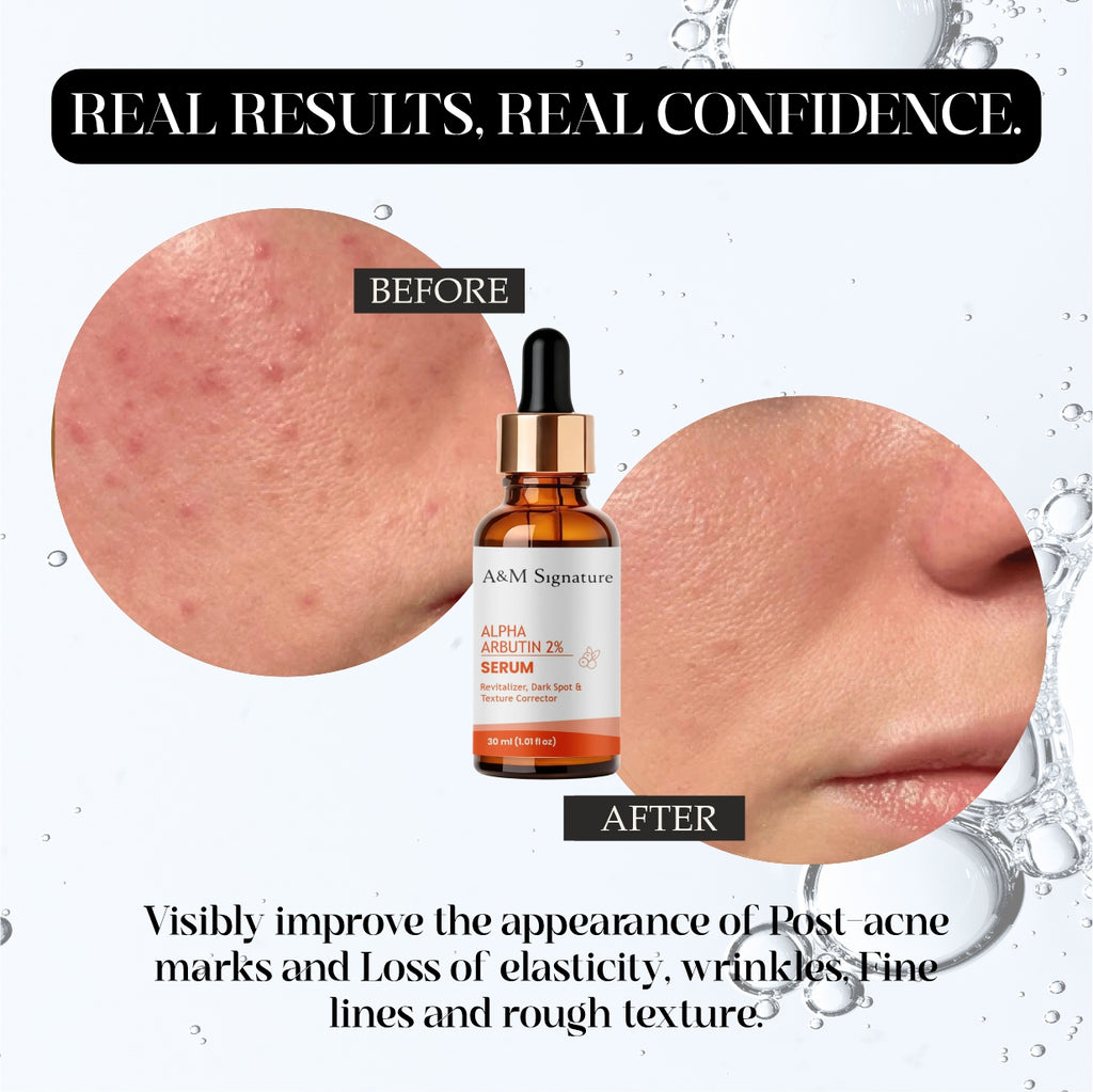 Alpha Arbutin 2% Serum for Dark Spots, Hyperpigmentation & Uneven Skin Tone – Brightening Face Serum with Texture Correction, Skin Revitalizer for Radiant, Smooth Skin