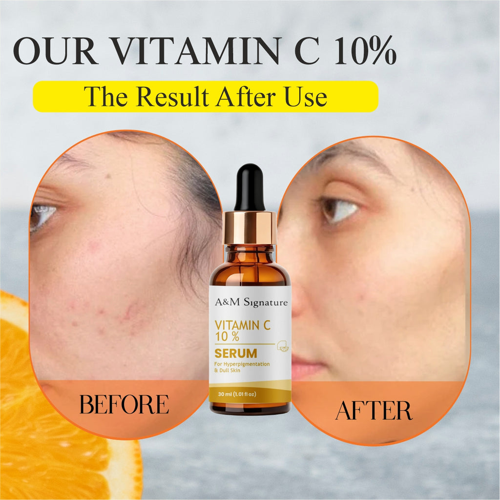A&M Signature Vitamin C Serum 10% for Brightening & Dark Spots – Antioxidant Face Serum for Glowing Skin, Even Tone, Anti-Aging & Skin Radiance Boosting Formula