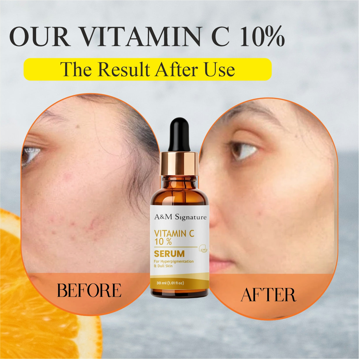 A&M Signature Vitamin C Serum 10% for Brightening & Dark Spots – Antioxidant Face Serum for Glowing Skin, Even Tone, Anti-Aging & Skin Radiance Boosting Formula
